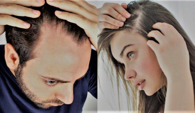 Saç dökülmesi nasıl önlenir ? Saç Dökülmesi için Bitkisel tedavi