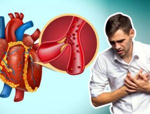 Gerçek Kalp Krizi Nasıl Olur?