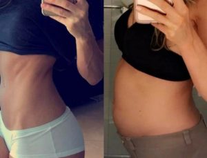 Evde Uygulayabileceğiniz Ödem Attırıcı Tarifler