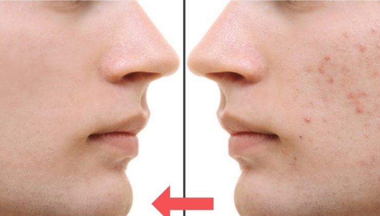 Sivilcelere Son! Sarımsağın Mucizevi Etkisini Gördüğünüzde Şok Olacaksınız!