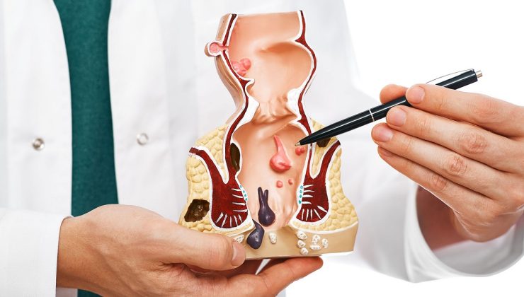 Basurun bitkisel ilacı nedir? Basuru hangi bitki yok eder?