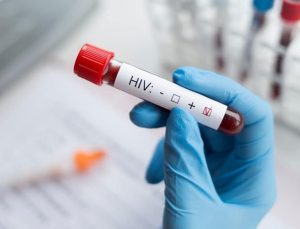 İzmir’de 13 yaşındaki çocuk AIDS’ten öldü