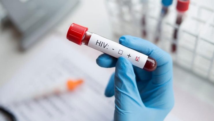 İzmir’de 13 yaşındaki çocuk AIDS’ten öldü