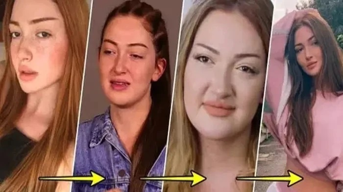 Danla Bilic estetikleri için servet harcadı